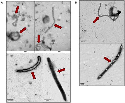 Extracellular vesicle storm during the course of Ebola virus infection in primates